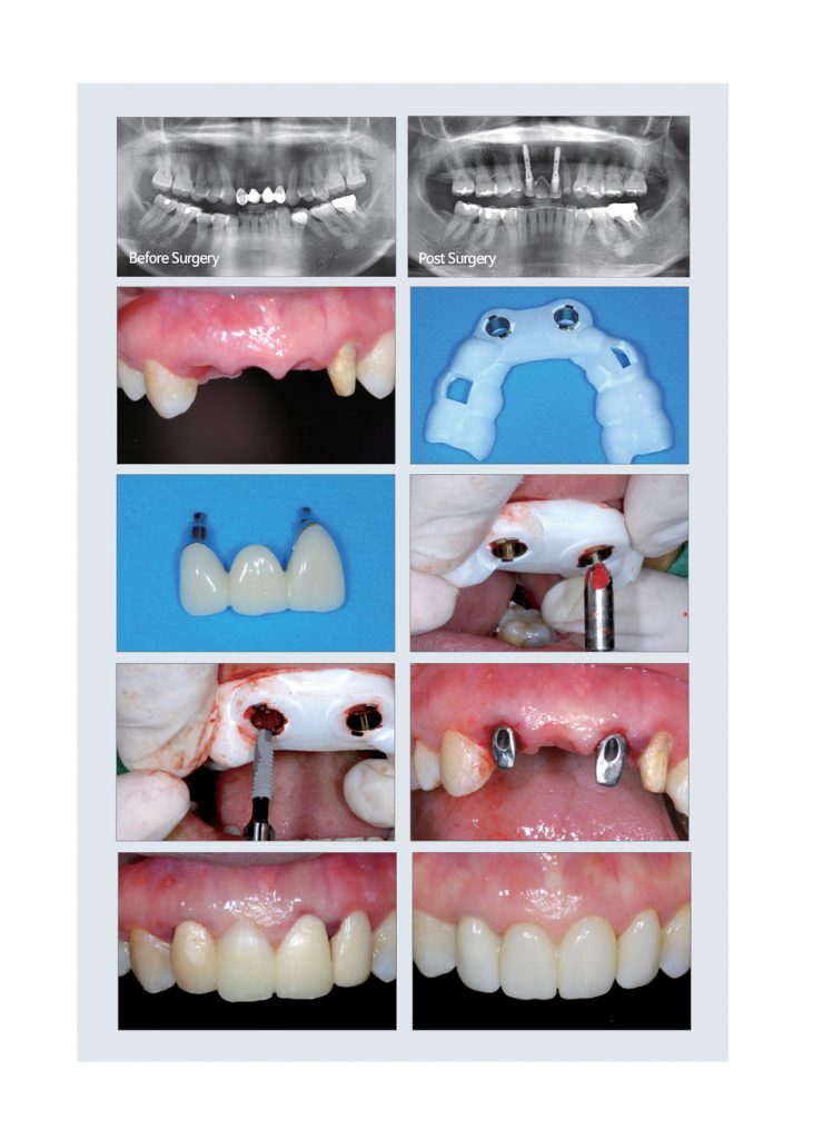 digital dentistry