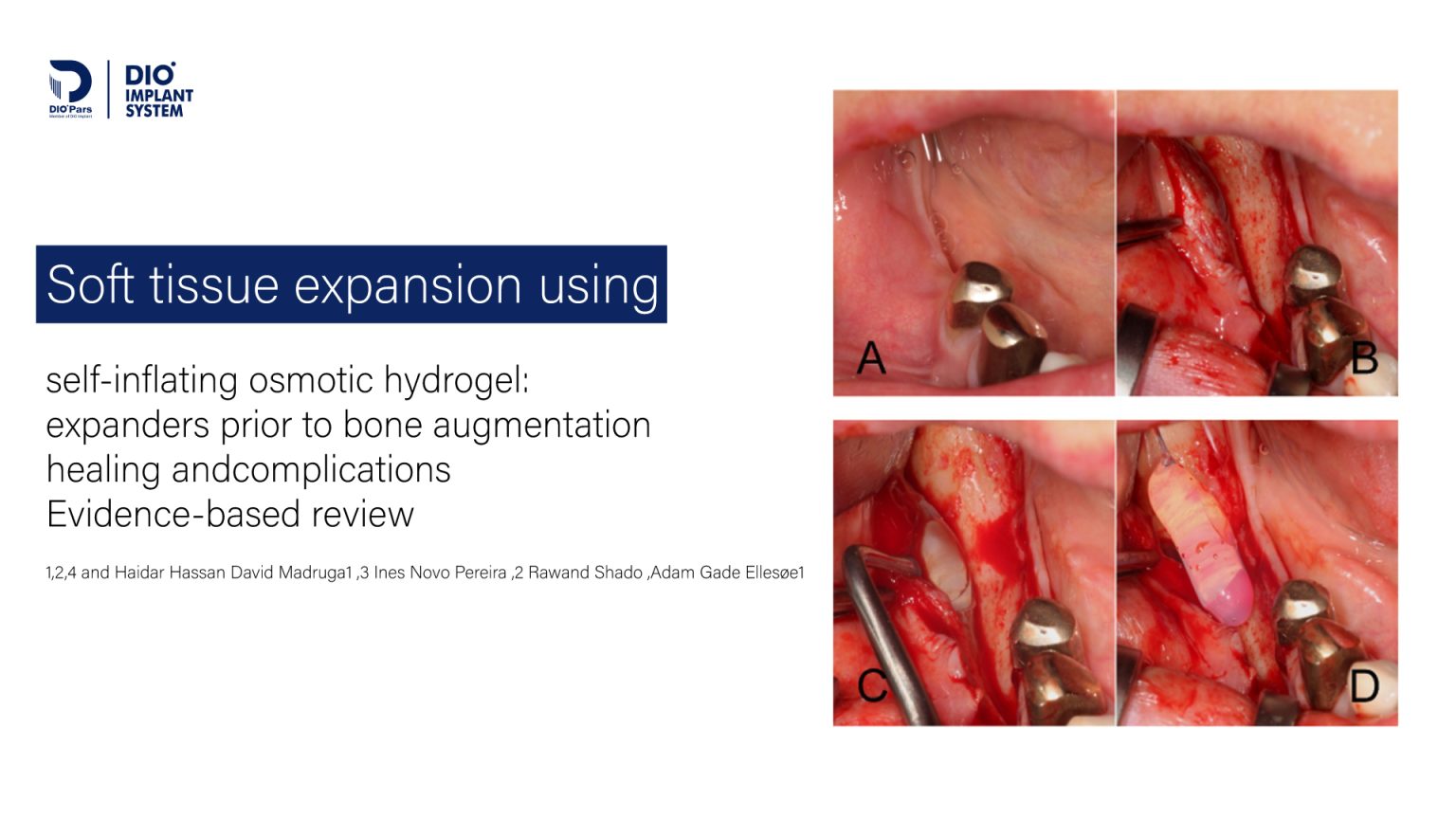 (SOHTE) self-inflating osmotic hydrogel expanders
