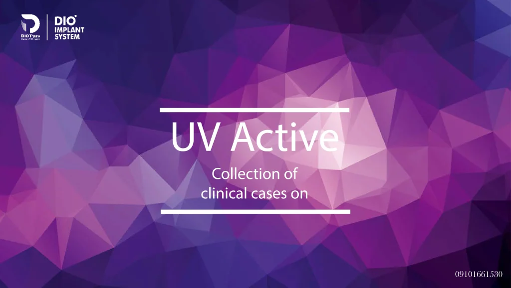 UV Activated Implants (ایمپلنت فعال‌شده با اشعه فرابنفش)