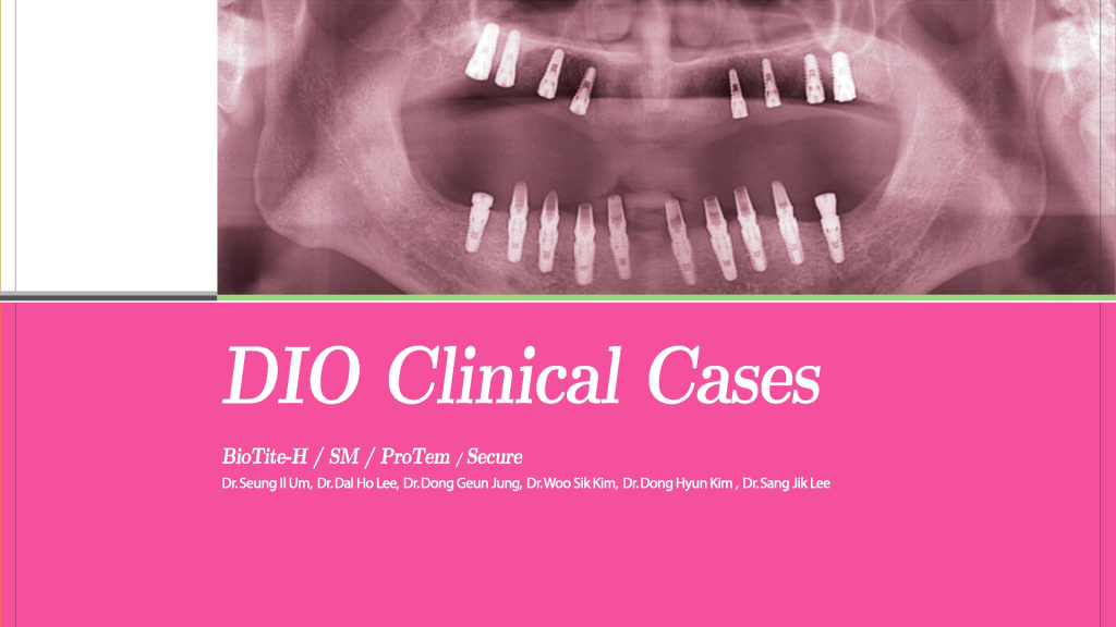 DIOnavi. Surgical Manual – Version 7.1