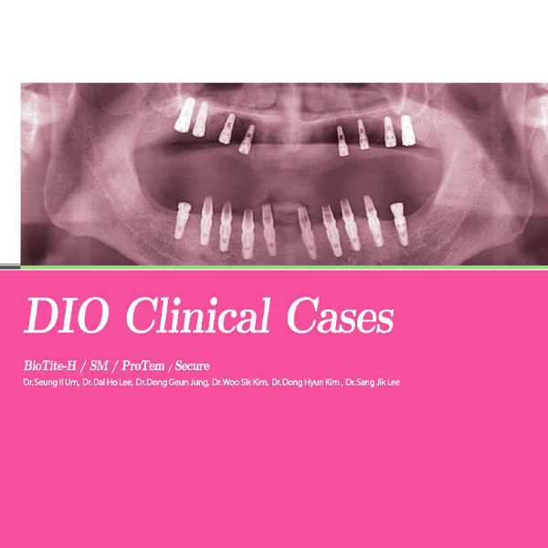 DIOnavi. Surgical Manual – Version 7.1