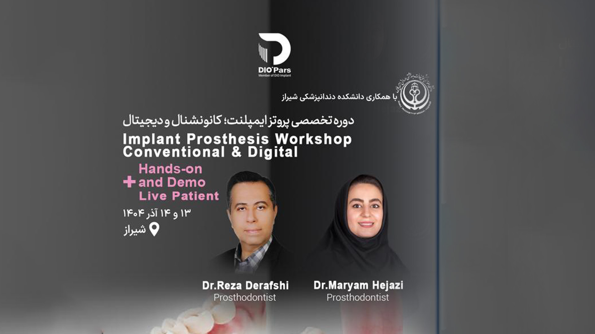 دوره آموزشی پروتز ایمپلنت