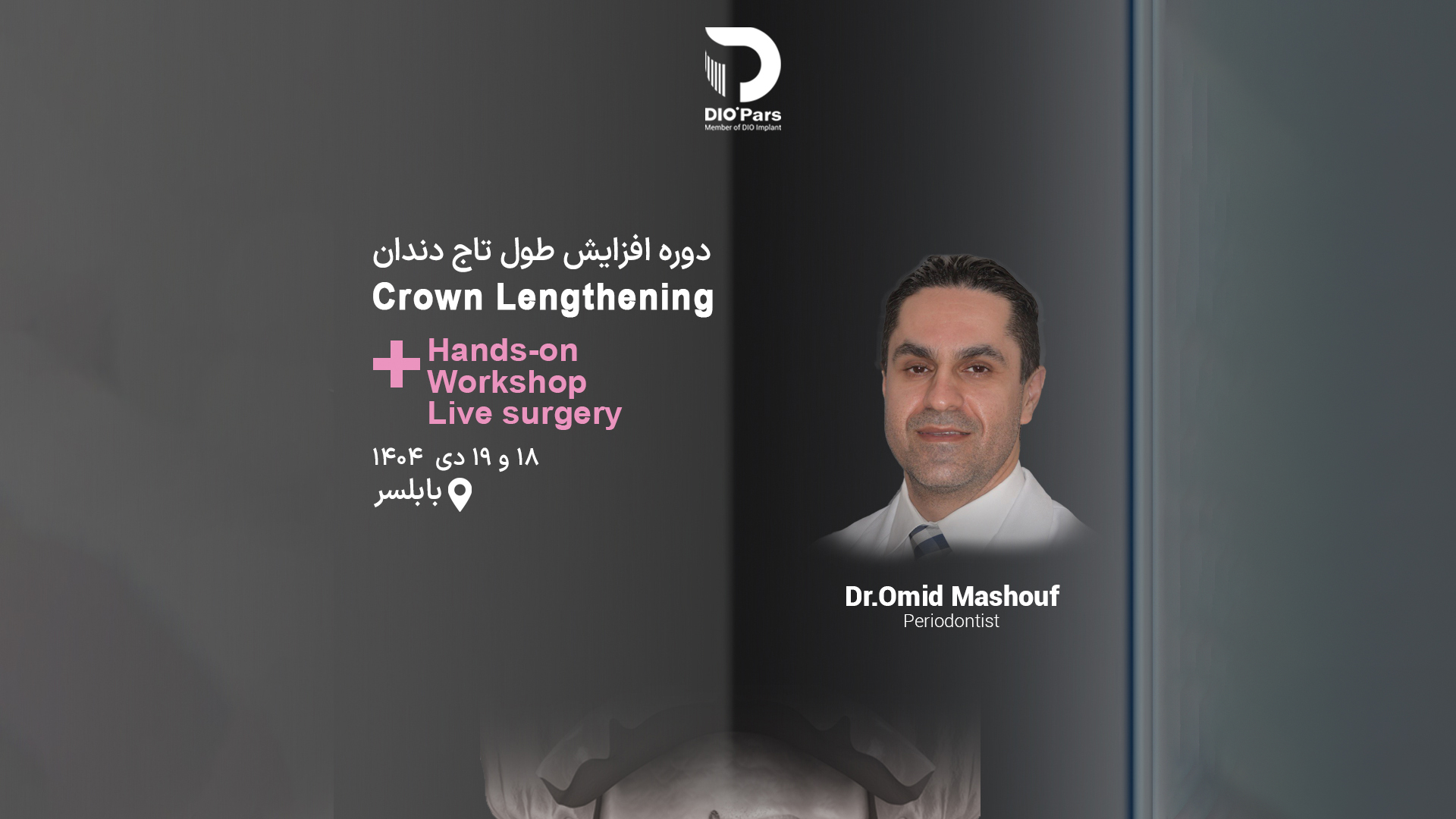 دوره جراحی افزایش طول تاج دندان