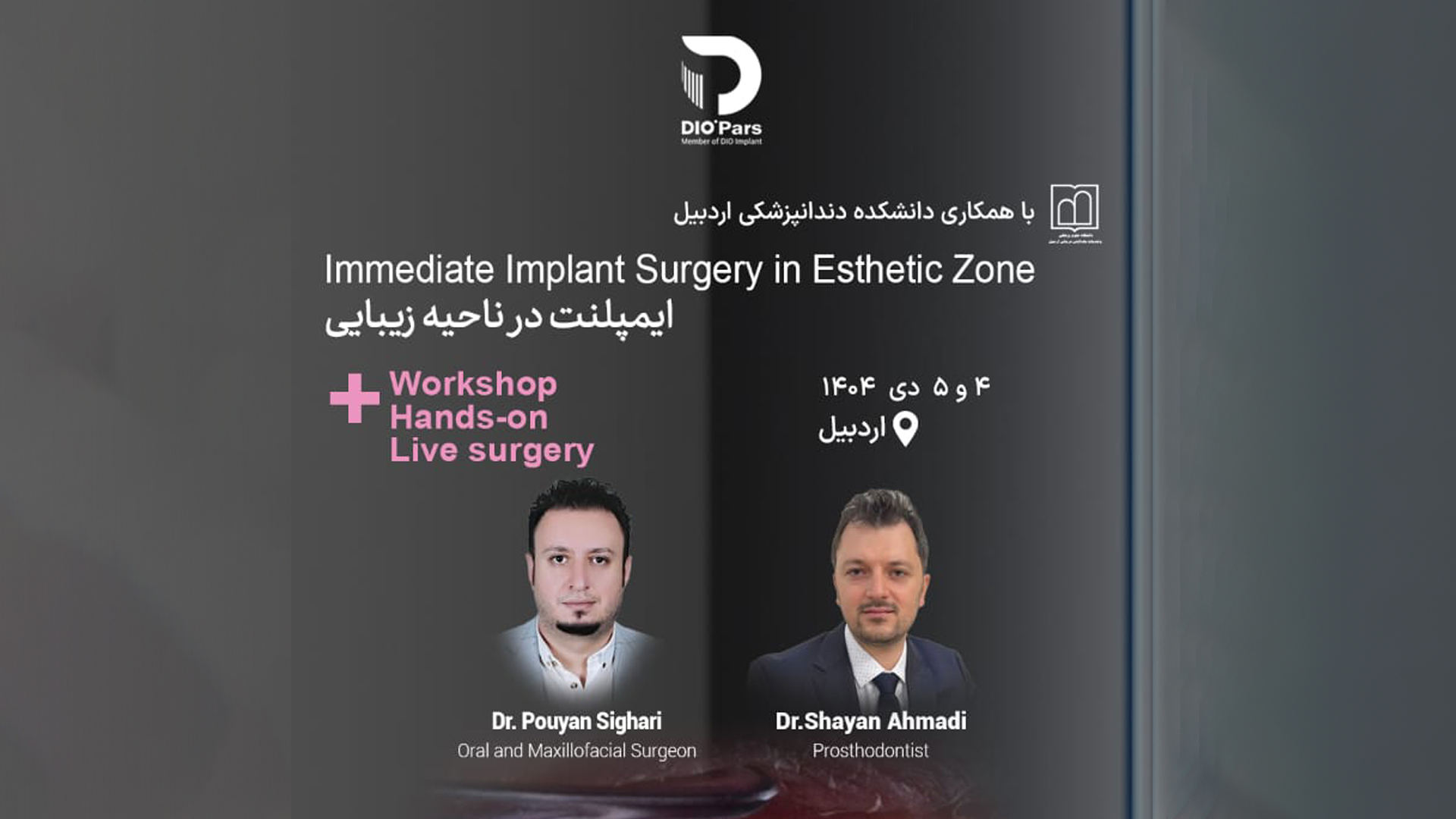 ایمپلنت در ناحیه زیبایی Immediate implant surgery in esthetic zone
